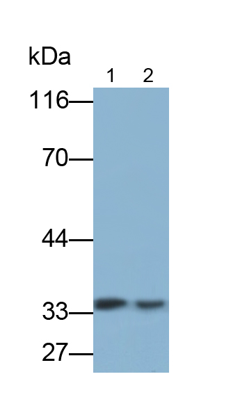 CD38分子(CD38)單克隆抗體