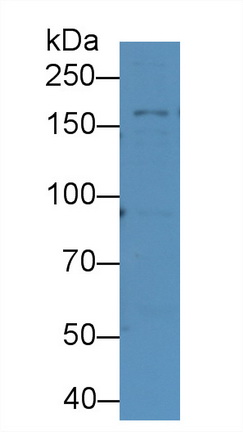 补体C3转化酶(C3 Convertase)单克隆抗体