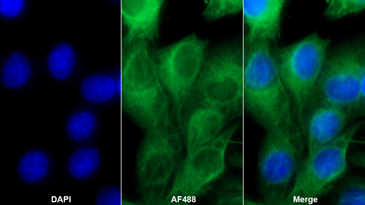 叉头框蛋白O1(FOXO1)单克隆抗体