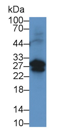 細(xì)胞程序性死亡蛋白1配體2(PDL2)單克隆抗體