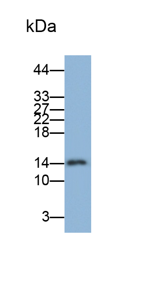 周期素依赖性激酶抑制因子2A(CDKN2A)单克隆抗体