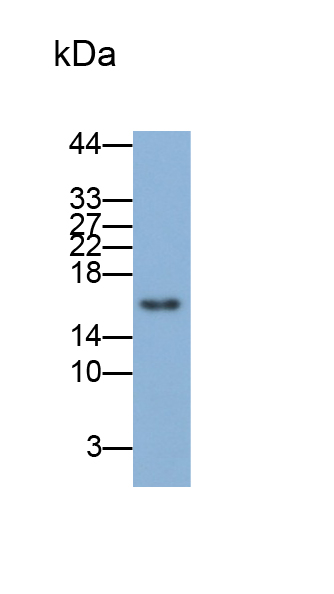 周期素依赖性激酶抑制因子2A(CDKN2A)单克隆抗体