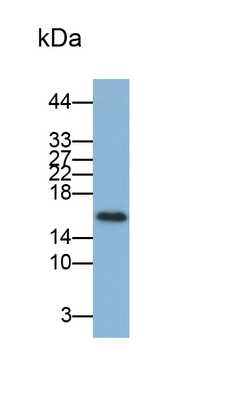 周期素依賴性激酶抑制因子2A(CDKN2A)單克隆抗體