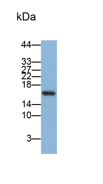 周期素依賴性激酶抑制因子2A(CDKN2A)單克隆抗體