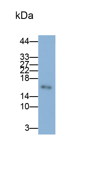 周期素依赖性激酶抑制因子2A(CDKN2A)单克隆抗体