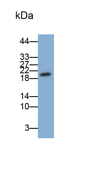 周期素依赖性激酶抑制因子2A(CDKN2A)单克隆抗体