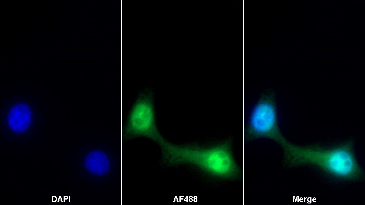 低氧诱导因子1α(HIF1a)单克隆抗体