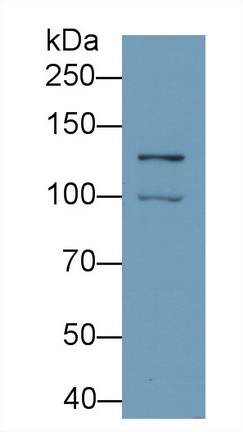 低氧诱导因子1α(HIF1a)单克隆抗体