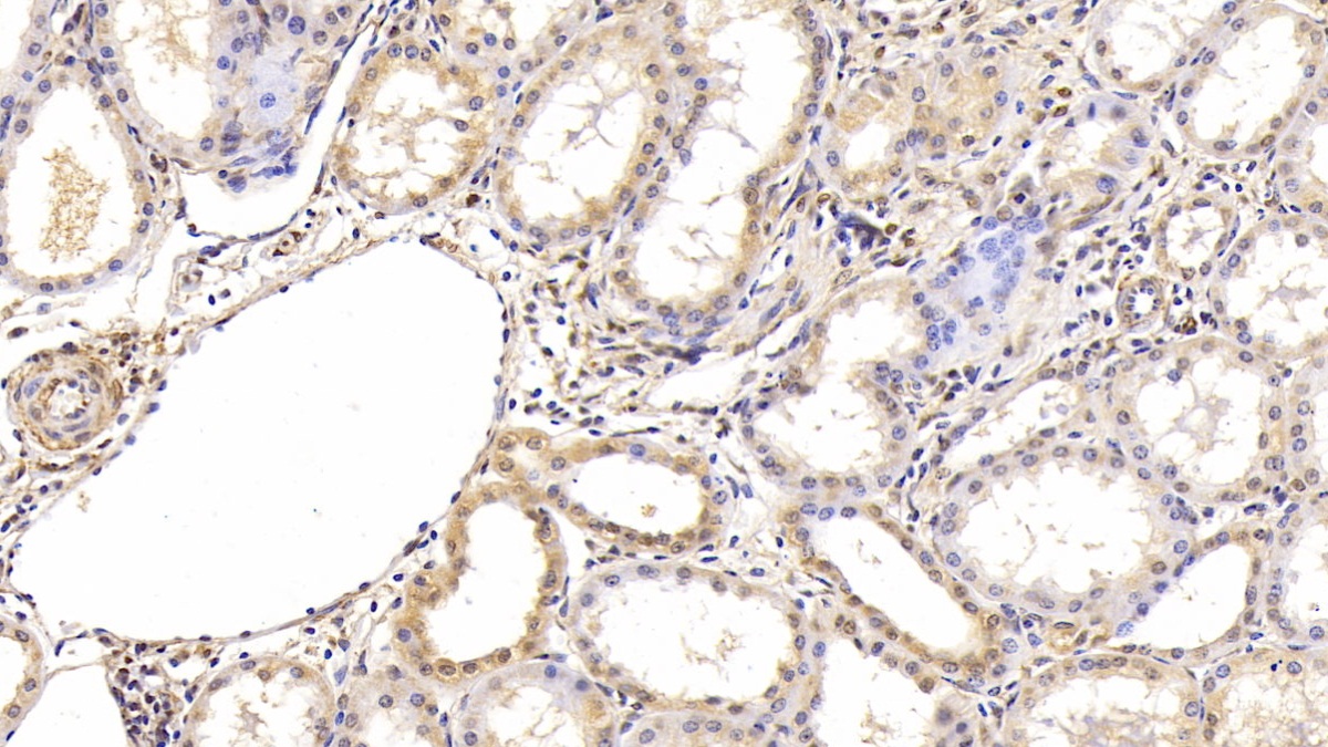 低氧诱导因子1α(HIF1a)单克隆抗体