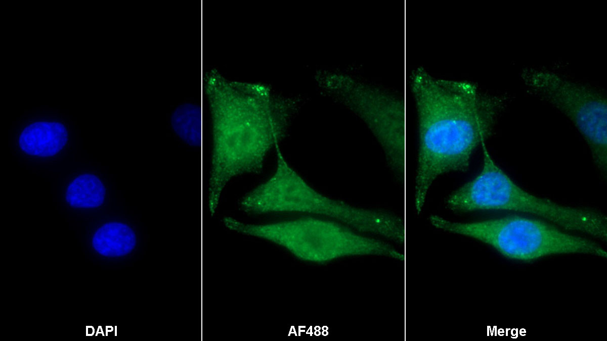 低氧诱导因子1α(HIF1a)单克隆抗体