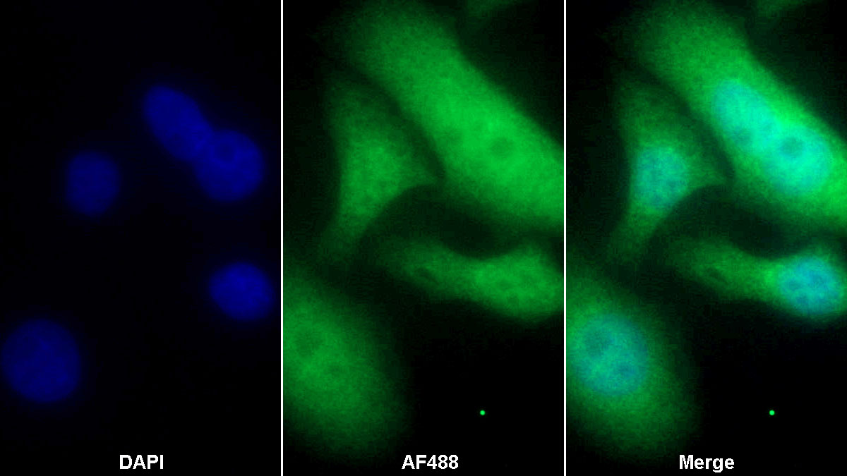 低氧诱导因子1α(HIF1a)单克隆抗体