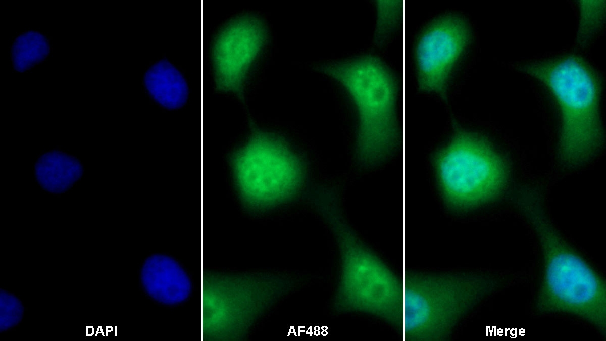 低氧诱导因子1α(HIF1a)单克隆抗体