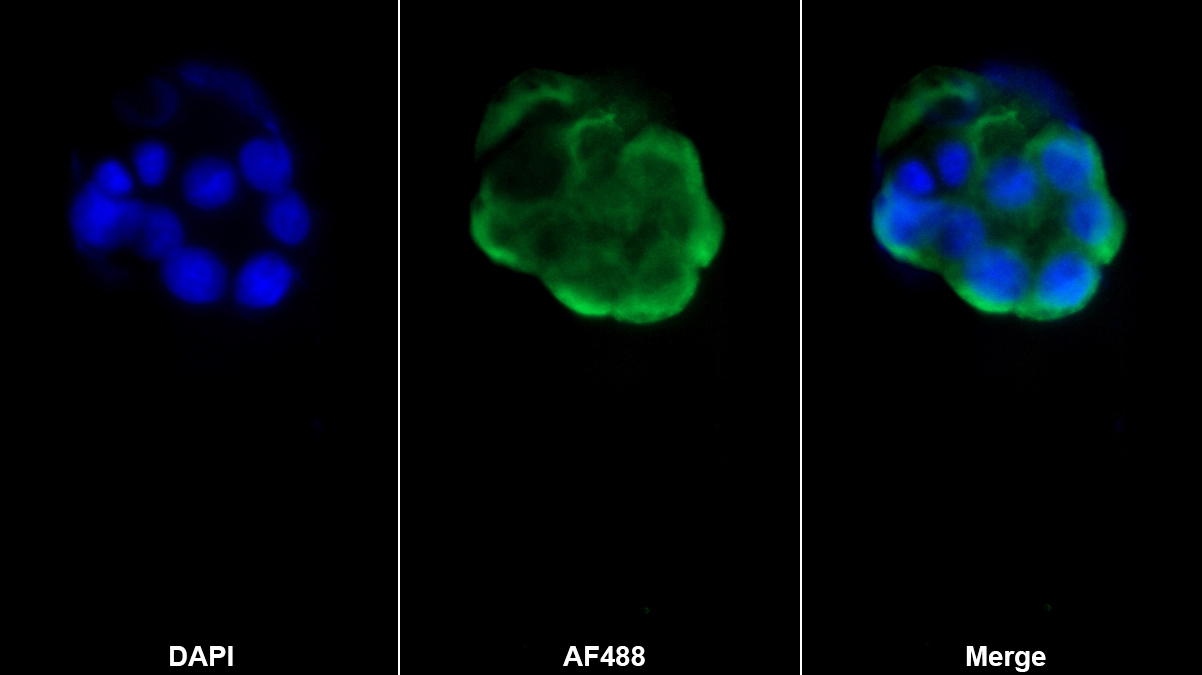 花生四烯酸-15-脂加氧酶(ALOX15)單克隆抗體