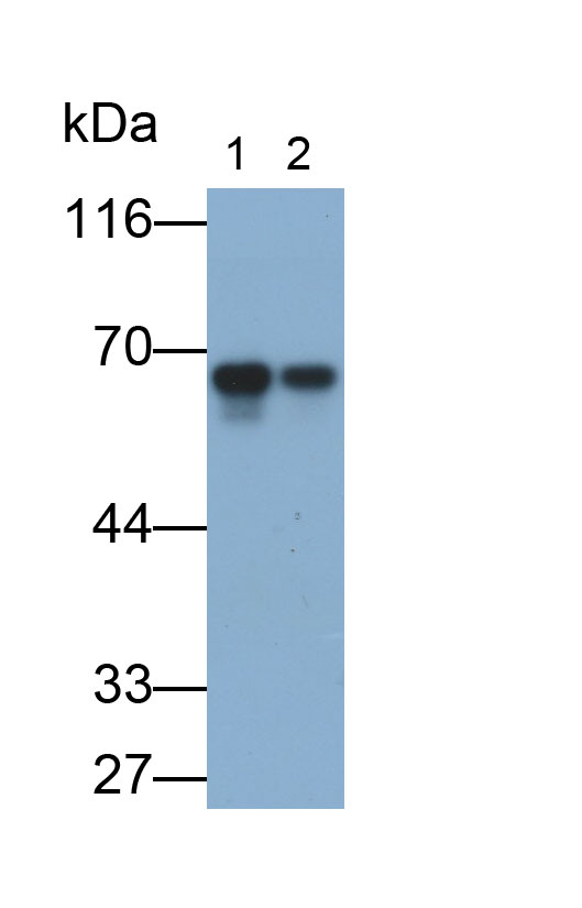 CD58分子(CD58)單克隆抗體
