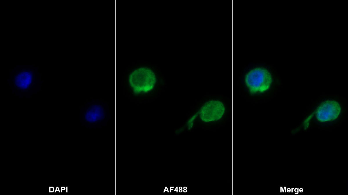 CD58分子(CD58)单克隆抗体