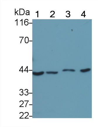 腫瘤蛋白p53(P53)單克隆抗體