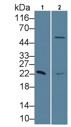视黄醇结合蛋白4(RBP4)单克隆抗体