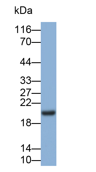 视黄醇结合蛋白4(RBP4)单克隆抗体