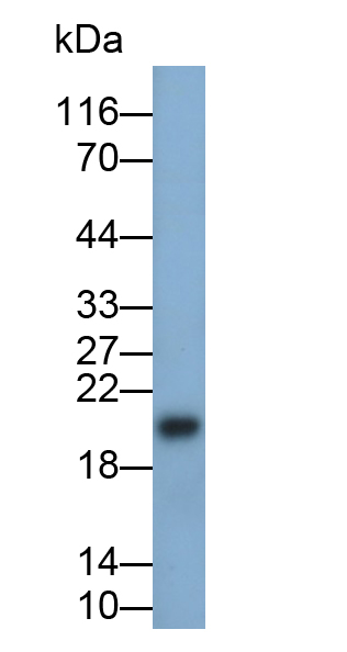 视黄醇结合蛋白4(RBP4)单克隆抗体