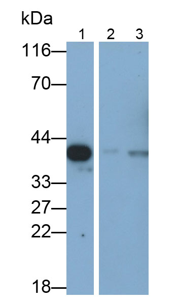 细胞外信号调节激酶2(ERK2)单克隆抗体