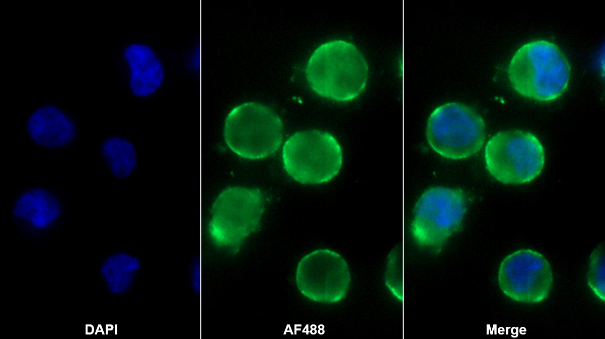 腎足蛋白(NPHN)單克隆抗體