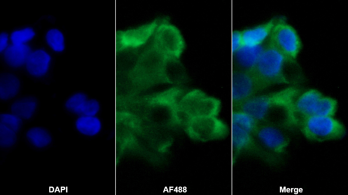 趨化素(CHEM)單克隆抗體