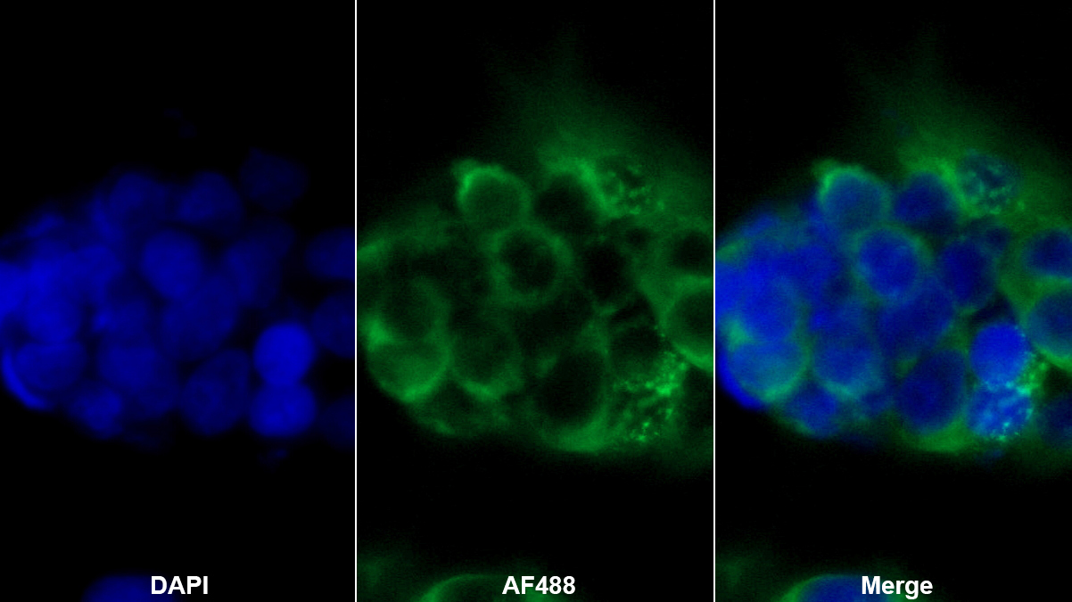 趋化素(CHEM)单克隆抗体