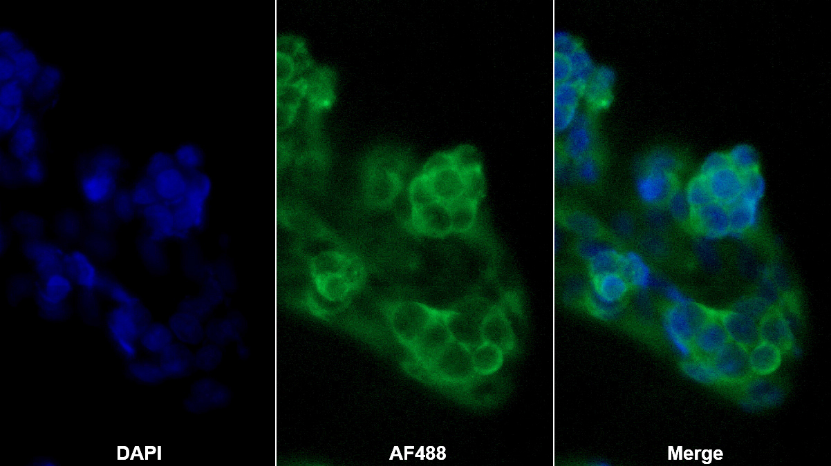 趨化素(CHEM)單克隆抗體