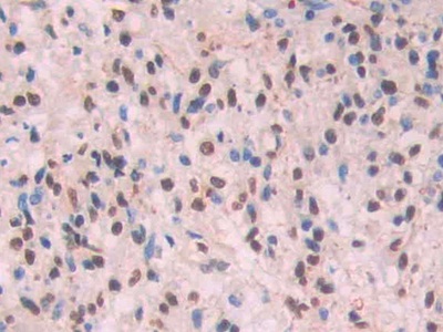 淀粉樣蛋白β1-42(Ab1-42)單克隆抗體