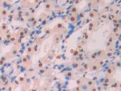 淀粉樣蛋白β1-42(Ab1-42)單克隆抗體