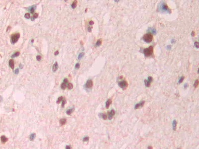 淀粉樣蛋白β1-42(Ab1-42)單克隆抗體