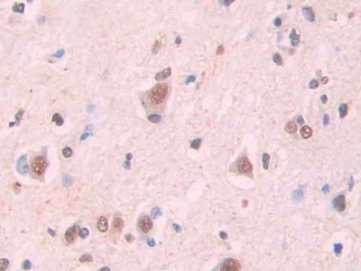 淀粉樣蛋白β1-42(Ab1-42)單克隆抗體