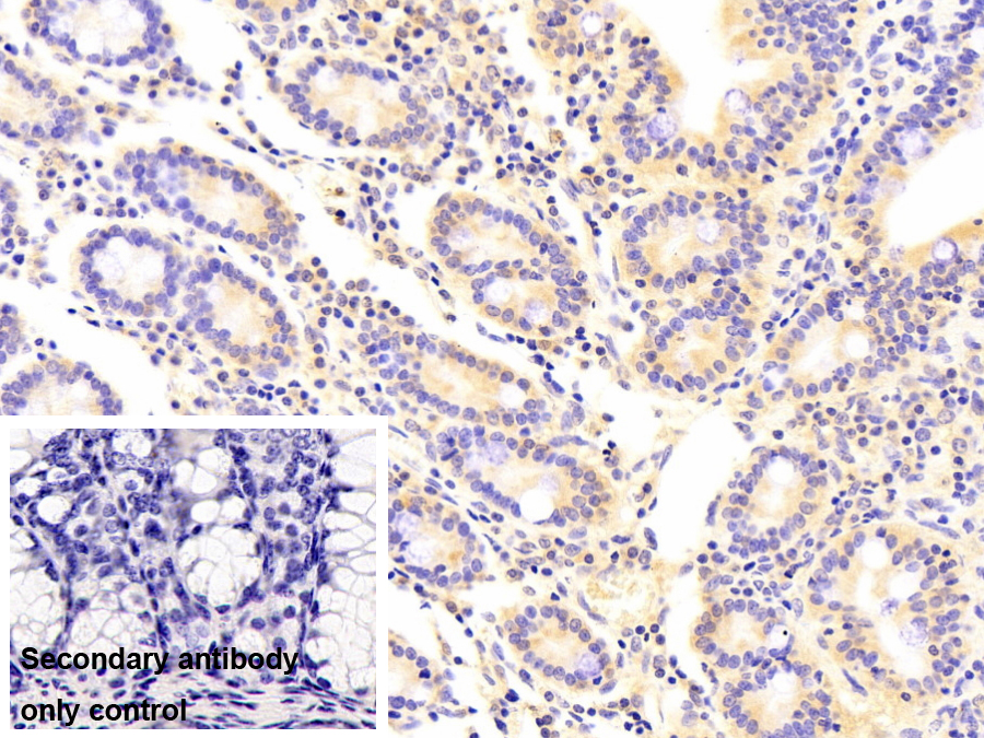 親環(huán)素A(CYPA)單克隆抗體