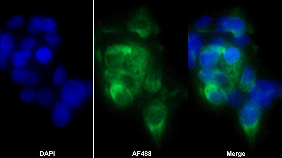 內(nèi)皮糖蛋白(ENG)單克隆抗體