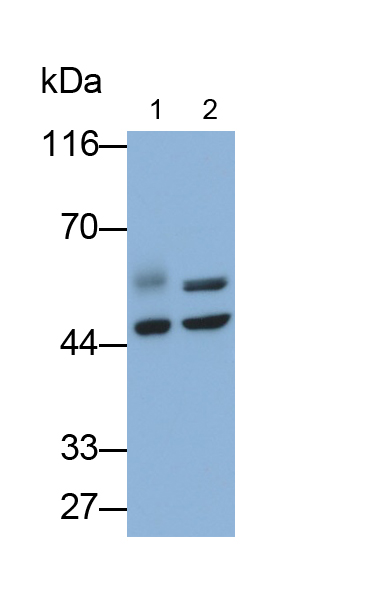 血管生成素樣蛋白4(ANGPTL4)單克隆抗體