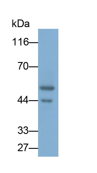 血管生成素样蛋白4(ANGPTL4)单克隆抗体