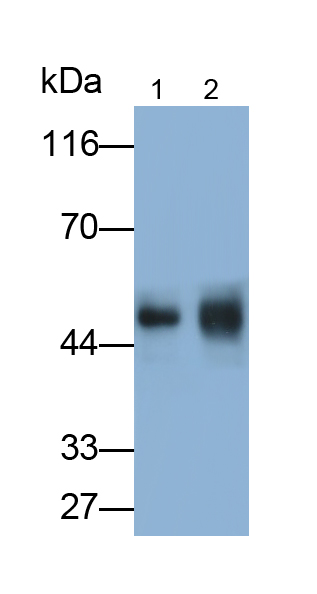 血管生成素樣蛋白4(ANGPTL4)單克隆抗體