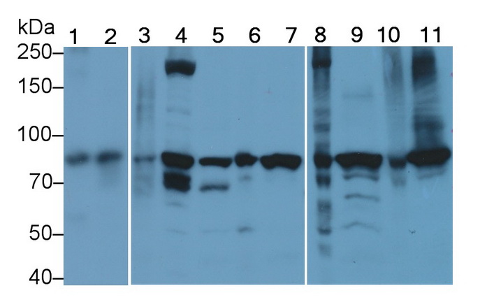 连环蛋白β1(β-catenin)单克隆抗体