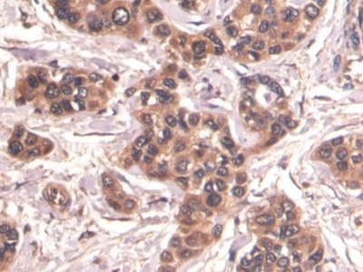 连环蛋白β1(β-catenin)单克隆抗体