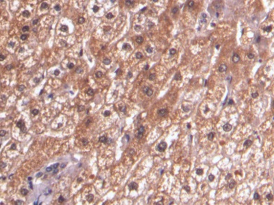 连环蛋白β1(β-catenin)单克隆抗体