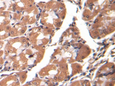 连环蛋白β1(β-catenin)单克隆抗体