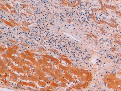 连环蛋白β1(β-catenin)单克隆抗体