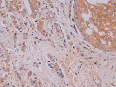 连环蛋白β1(β-catenin)单克隆抗体