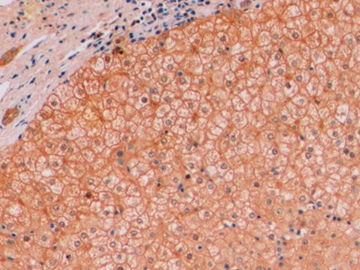 连环蛋白β1(β-catenin)单克隆抗体