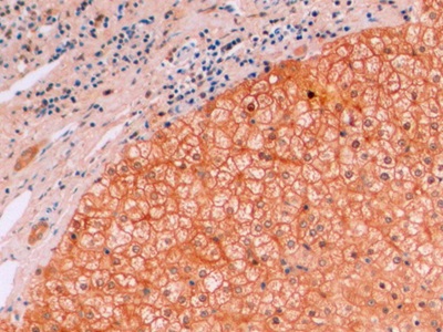 连环蛋白β1(β-catenin)单克隆抗体