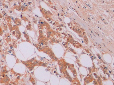 连环蛋白β1(β-catenin)单克隆抗体