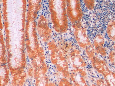 连环蛋白β1(β-catenin)单克隆抗体