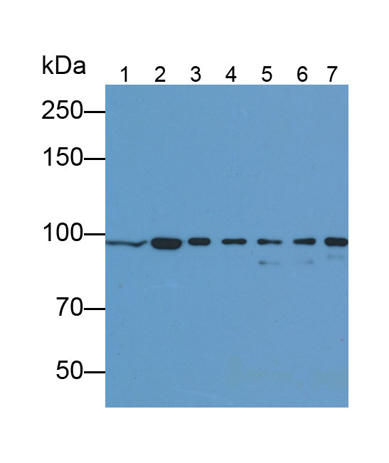 连环蛋白β1(β-catenin)单克隆抗体