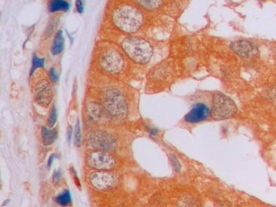 连环蛋白β1(β-catenin)单克隆抗体