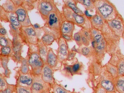 连环蛋白β1(β-catenin)单克隆抗体